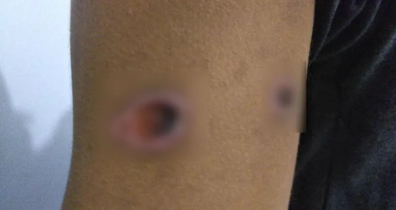 Diduga Alami Luka Tembak, Mahasiswa UHO Lapor ke Ombudsman Sultra