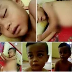 Bayi Pengidap Leukimia Asal Konut Butuh Uluran Tangan Bayi Pengidap Leukimia Asal Konut Butuh Uluran Tangan
