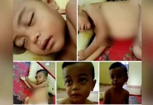 Bayi Pengidap Leukimia Asal Konut Butuh Uluran Tangan Bayi Pengidap Leukimia Asal Konut Butuh Uluran Tangan