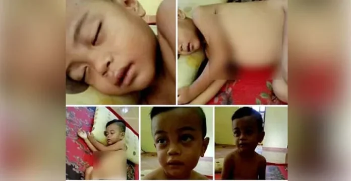 Bayi Pengidap Leukimia Asal Konut Butuh Uluran Tangan