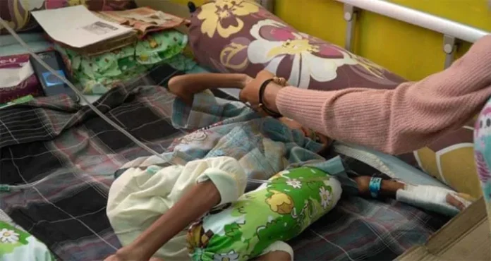 Balita 3 Tahun Asal Batu Atas Busel Menderita Gizi Buruk