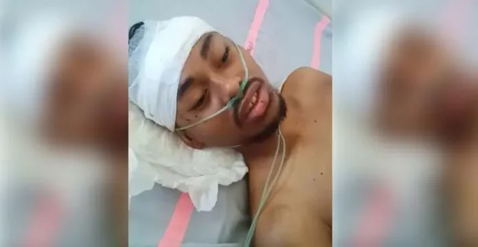 Begal Terjadi di Area Kampus UHO, Mahasiswa Pertanian Jadi Korban