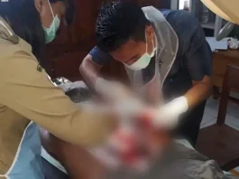 Seorang Petani di Bombana Diserang Buaya Hingga Tak Sadarkan Diri Seorang Petani di Bombana Diserang Buaya Hingga Tak Sadarkan Diri