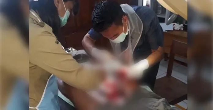 Seorang Petani di Bombana Diserang Buaya Hingga Tak Sadarkan Diri