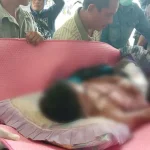 Batang Besi yang Tertancap di Dada Pemuda Wakatobi Berhasil Dicabut Pemuda Wakatobi Ini Ditikam Pakai Batang Besi Saat Tidur