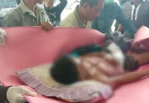Batang Besi yang Tertancap di Dada Pemuda Wakatobi Berhasil Dicabut Pemuda Wakatobi Ini Ditikam Pakai Batang Besi Saat Tidur