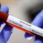 Kasus Positif Covid-19 Pertama di Busel dari Klaster KM Dorolonda 826 Rapid Test Didistribusikan ke Kabupaten dan Kota di Sultra