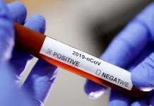 Pemkab Konsel Telah Terima Alat Rapit Test untuk Deteksi Corona 826 Rapid Test Didistribusikan ke Kabupaten dan Kota di Sultra