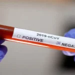 Hasil Swab Satu PDP di Butur Negatif Covid-19 PDP Asal Kolaka yang Meninggal di RSUD Bahteramas Negatif Covid-19