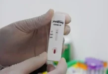 Pemkab Kolaka Anggarkan Rp5 Miliar untuk Belanja Alat Swab Test Hasil Rapid Test, Enam Warga Wakatobi Reaktif Corona