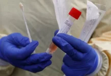 Sulawesi Tenggara Uji PCR Covid-19 Secara Mandiri Gugus Tugas Kolaka Siapkan Tenaga Medis untuk Pengambilan Sampel Tes Swab