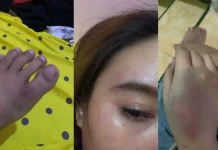 Ini Pengakuan Korban Penganiayaan yang Dilakukan Anak Pimpinan DPRD Konawe Ini Pengakuan Korban Penganiayaan yang Dilakukan Anak Pimpinan DPRD Konawe