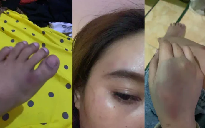 Ini Pengakuan Korban Penganiayaan yang Dilakukan Anak Pimpinan DPRD Konawe