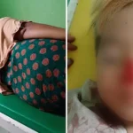 Anjing Gila Serang Empat Warga Kolut, Satu Orang di Antaranya Balita Anjing Gila Serang Empat Warga Kolut, Satu Orang di Antaranya Balita