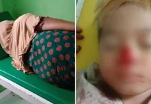 Anjing Gila Serang Empat Warga Kolut, Satu Orang di Antaranya Balita Anjing Gila Serang Empat Warga Kolut, Satu Orang di Antaranya Balita