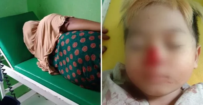 Anjing Gila Serang Empat Warga Kolut, Satu Orang di Antaranya Balita