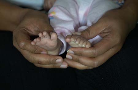 Bayi Kembar di Baubau Lahir dengan 12 Jari Kaki