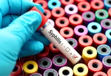 Dinkes Baubau Deteksi 16 Orang Positif Sifilis di Lapas dan THM Dinkes Baubau Deteksi 16 Orang Positif Sifilis di Lapas dan THM