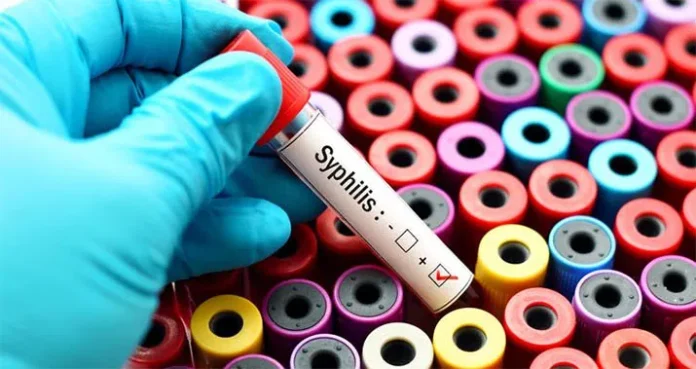 Dinkes Baubau Deteksi 16 Orang Positif Sifilis di Lapas dan THM