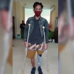 Satu Karyawan VDNI Dapat Bantuan Kaki Palsu dari BP Jamsostek Satu Karyawan VDNI Dapat Bantuan Kaki Palsu dari BP Jamsostek