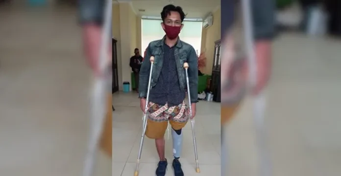 Satu Karyawan VDNI Dapat Bantuan Kaki Palsu dari BP Jamsostek