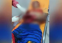 Terlibat Perkelahian, Satu Warga di Baubau Terluka Terlibat Perkelahian, Satu Warga di Baubau Terluka