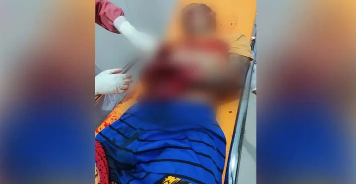 Terlibat Perkelahian, Satu Warga di Baubau Terluka