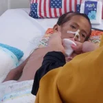 Cerita Pilu Gale, Bocah Penderita Gizi Buruk di Kendari