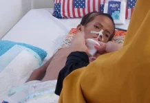 Cerita Pilu Gale, Bocah Penderita Gizi Buruk di Kendari