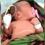 Lahir Tanpa Anus, Bayi Perempuan di Muna Butuh Uluran Tangan Lahir Tanpa Anus, Bayi Perempuan di Muna Butuh Uluran Tangan