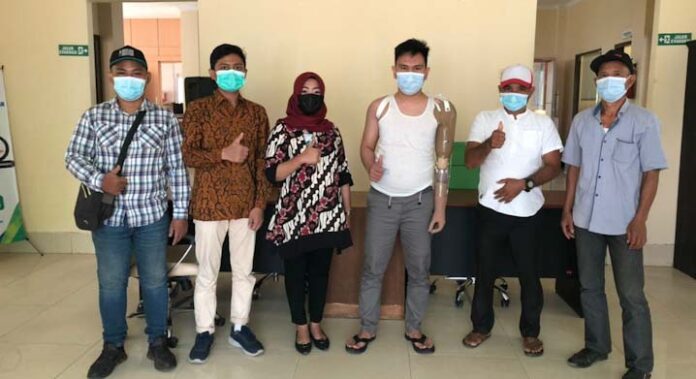 BPJamsostek Serahkan Tangan Palsu ke Pekerja PT VDNI