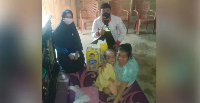 ASR Berikan Bantuan kepada Bayi Pengidap Hidrosefalus di Konsel