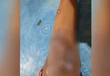 Orang Tua Santri Ponpes Al Islam Kolut Keluhkan Anaknya Terserang Gatal Orang Tua Santri Ponpes Al Islam Kolut Keluhkan Anaknya Terserang Gatal