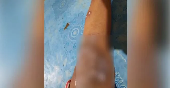 Orang Tua Santri Ponpes Al Islam Kolut Keluhkan Anaknya Terserang Gatal