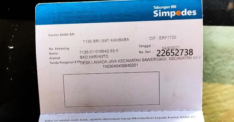 Balita Penderita Ginjal Bocor di Mubar Butuh Uluran Tangan