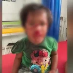 Empat Warga Kolut Diserang Anjing Liar Empat Warga Kolut Diserang Anjing Liar