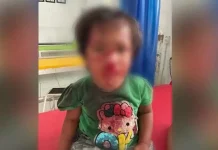 Empat Warga Kolut Diserang Anjing Liar Empat Warga Kolut Diserang Anjing Liar