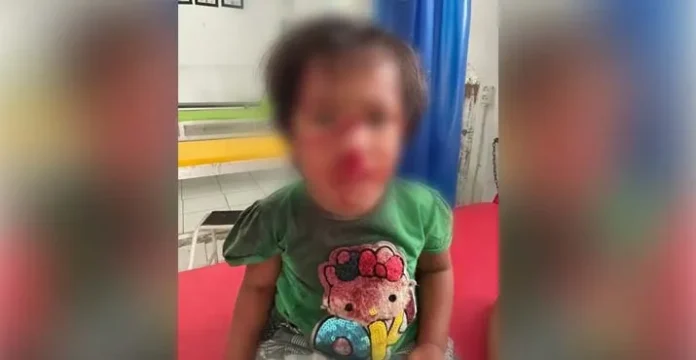 Empat Warga Kolut Diserang Anjing Liar