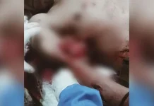 Tangan Seorang Warga di Mubar Nyaris Putus Usai Diterkam Buaya Tangan Seorang Warga di Mubar Nyaris Putus Usai Diterkam Buaya