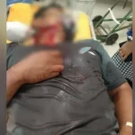 Tidur di Atas Meja, Leher Seorang Warga di Mubar Disayat Tidur di Atas Meja, Leher Seorang Warga di Mubar Disayat