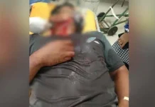 Tidur di Atas Meja, Leher Seorang Warga di Mubar Disayat Tidur di Atas Meja, Leher Seorang Warga di Mubar Disayat