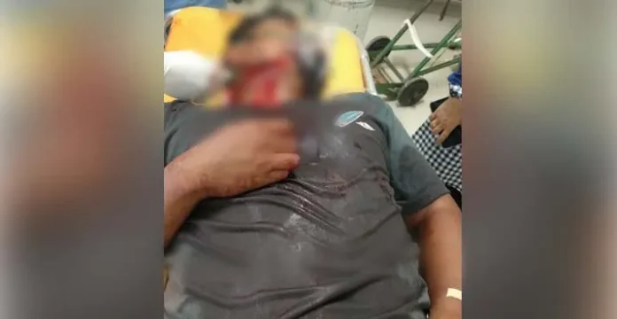 Tidur di Atas Meja, Leher Seorang Warga di Mubar Disayat