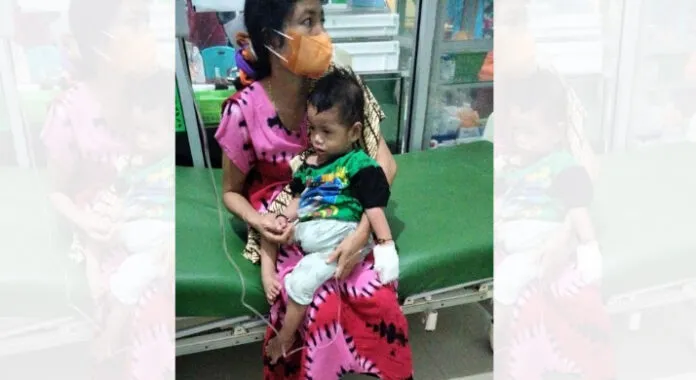 Idap Penyakit Parah, Balita di Buton Butuh Bantuan