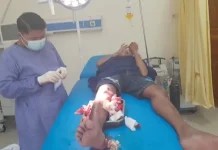 Korban Pembusuran di Depan Kampus UHO Dioperasi dengan 30 Jahitan Korban Pembusuran di Depan Kampus UHO Dioperasi dengan 30 Jahitan