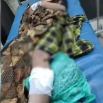 Seorang Wanita di Kendari Jadi Korban Busur Saat Berkendara Seorang Wanita di Kendari Jadi Korban Busur Saat Berkendara