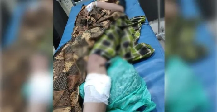 Seorang Wanita di Kendari Jadi Korban Busur Saat Berkendara