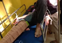Seorang Remaja Alami Patah Tulang Kaki Akibat Bertabrakan dengan Truk Seorang Remaja Alami Patah Tulang Kaki Akibat Bertabrakan dengan Truk