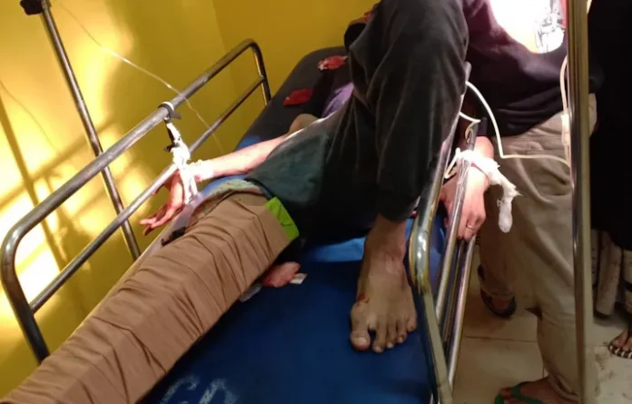 Seorang Remaja Alami Patah Tulang Kaki Akibat Bertabrakan dengan Truk