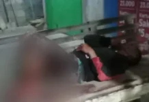 Seorang Pria Warga Puuwatu Dibacok dengan Parang Berulang Kali Seorang Pria Warga Puuwatu Dibacok dengan Parang Berulang Kali