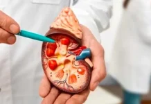 Update Kasus Gagal Ginjal Akut: Terdapat Tiga Kasus di Sultra Ilustrasi Gagal Ginjal Akut